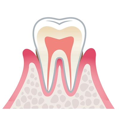 健全な歯周組織